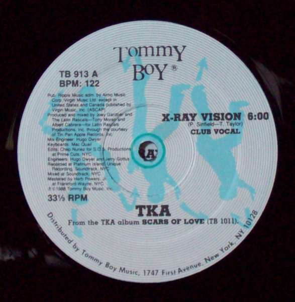 X-Ray Vision TKA