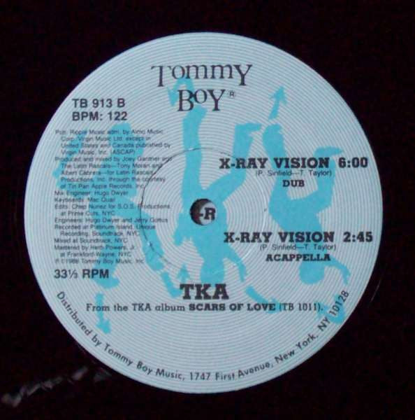 X-Ray Vision TKA
